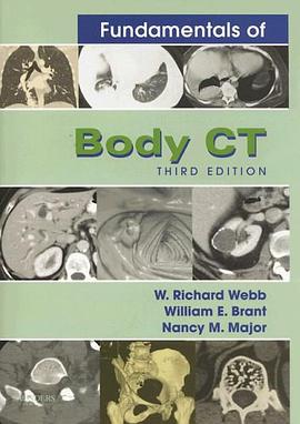 Fundamentals of Body Ct pdf epub mobi 电子书 下载