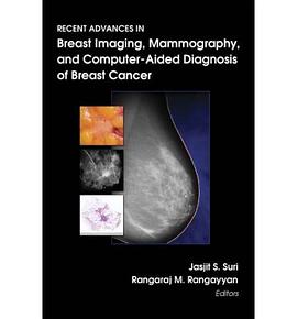 Recent Advances in Breast Imaging, Mammography, And Computer-Aided Diagnosis of Breast Cancer pdf epub mobi 电子书 下载