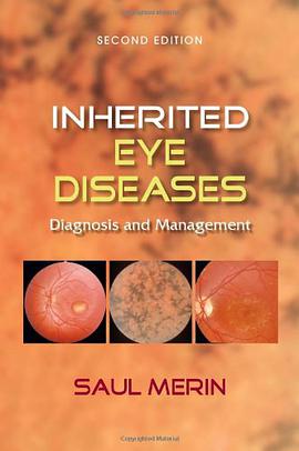 Inherited Eye Diseases Diagnosis and Management