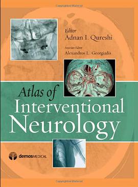 Atlas of Interventional Neurology pdf epub mobi 電子書 下載