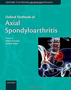 Oxford Textbook of Axial Spondyloarthritis pdf epub mobi 电子书 下载