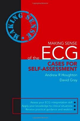 Making Sense of the ECG pdf epub mobi 电子书 下载