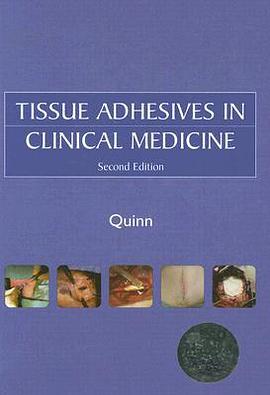 Tissue Adhesives in Wound Care pdf epub mobi 電子書 下載
