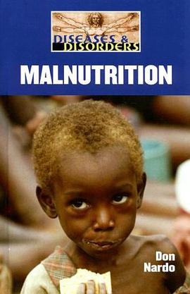 Malnutrition pdf epub mobi 电子书 下载
