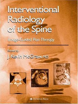Interventional Radiology of the Spine pdf epub mobi 电子书 下载