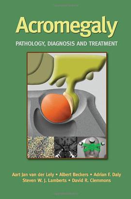 Acromegaly pdf epub mobi 电子书 下载