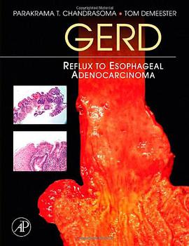 GERD pdf epub mobi 电子书 下载