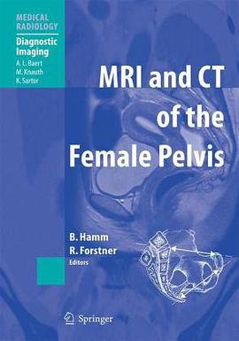 MRI and CT of the Female Pelvis pdf epub mobi 电子书 下载