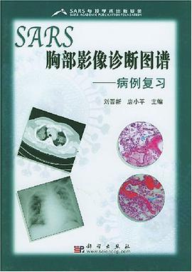 SARS胸部影像诊断图谱 pdf epub mobi 电子书 下载