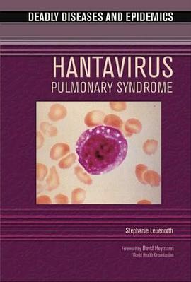Hantavirus Pulmonary Syndrome pdf epub mobi 电子书 下载