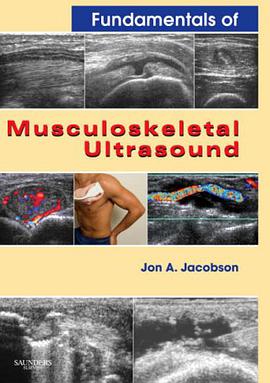 Fundamentals of Musculoskeletal Ultrasound (Fundamentals of Radiology) pdf epub mobi 电子书 下载