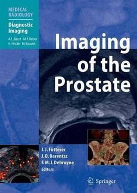 Imaging of the Prostate pdf epub mobi 电子书 下载