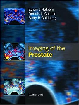 Imaging of the Prostate pdf epub mobi 电子书 下载