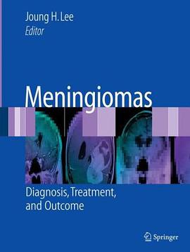 Meningiomas pdf epub mobi 電子書 下載