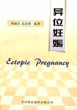 异位妊娠 pdf epub mobi 下载