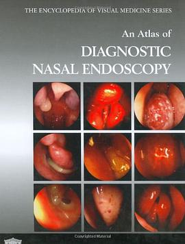 An Atlas of Diagnostic Nasal Endoscopy pdf epub mobi 电子书 下载