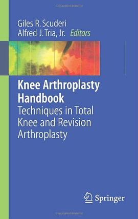 Knee Arthroplasty Handbook pdf epub mobi 电子书 下载