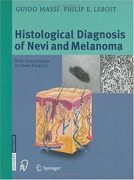 The Histological Diagnosis of Nevi and Melanoma pdf epub mobi 下载