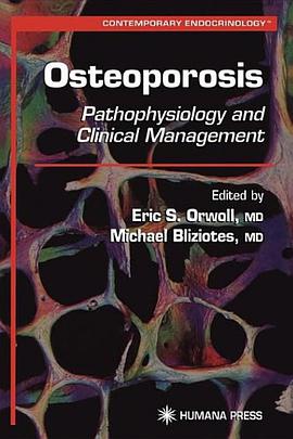 Osteoporosis pdf epub mobi 电子书 下载