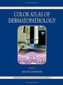 Color Atlas of Dermatopathology