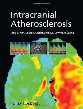 Intracranial Atherosclerosis pdf epub mobi 电子书 下载