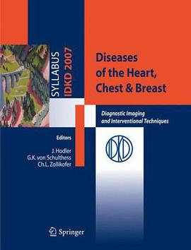 Diseases of the Heart, Chest and Breast pdf epub mobi 电子书 下载