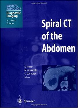 Spiral CT of the Abdomen pdf epub mobi 电子书 下载
