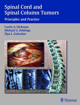 Spinal Chord and Spinal Column Tumors pdf epub mobi 电子书 下载