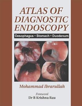 Atlas of Diagnostic Endoscopy pdf epub mobi 电子书 下载