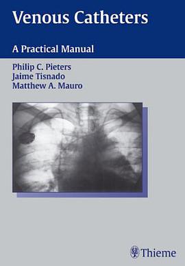 Venous Catheters pdf epub mobi 电子书 下载
