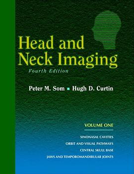Head and Neck Imaging pdf epub mobi 电子书 下载