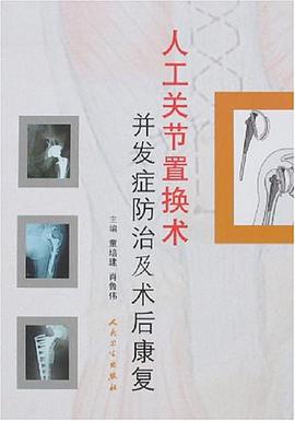 人工关节置换术并发症防治及术后康复 pdf epub mobi 电子书 下载
