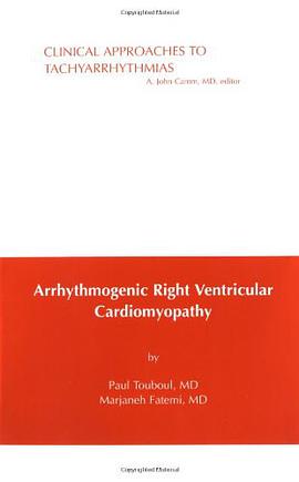 Arrhythmogenic Right Ventricular Cardiomyopathies