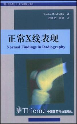 正常X线表现 pdf epub mobi 电子书 下载
