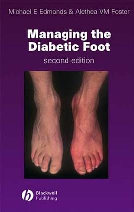 Managing the Diabetic Foot pdf epub mobi 下载
