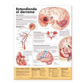 Understanding Stroke Anatomical Chart in Spanish pdf epub mobi 电子书 下载