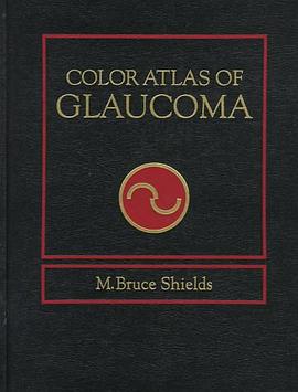 Color Atlas of Glaucoma pdf epub mobi 電子書 下載