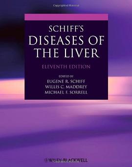 Schiff's Diseases of the Liver pdf epub mobi 电子书 下载