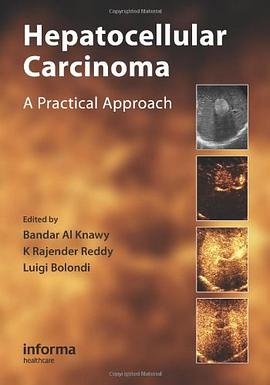 Hepatocellular Carcinoma pdf epub mobi 电子书 下载