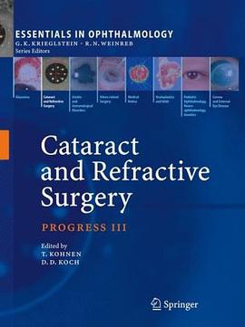 Cataract and Refractive Surgery pdf epub mobi 电子书 下载
