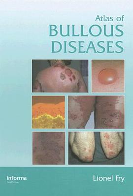 Atlas of Bullous Diseases pdf epub mobi 电子书 下载