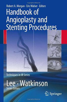 Handbook of Angioplasty and Stenting Procedures pdf epub mobi 电子书 下载