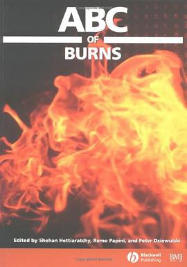 ABC of Burns pdf epub mobi 电子书 下载