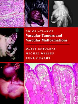 Color Atlas of Vascular Tumors and Vascular Malformations pdf epub mobi 电子书 下载