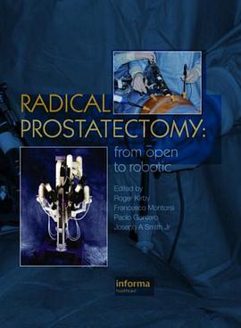 Radical Prostatectomy pdf epub mobi 电子书 下载