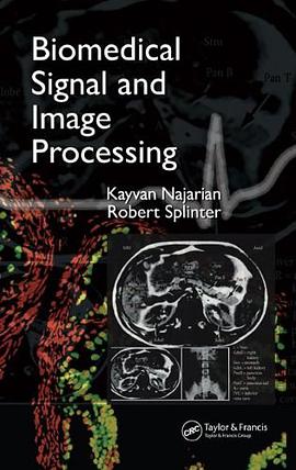 Biomedical Signal and Image Processing pdf epub mobi 电子书 下载