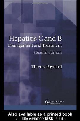 Hepatitis B and C pdf epub mobi 电子书 下载