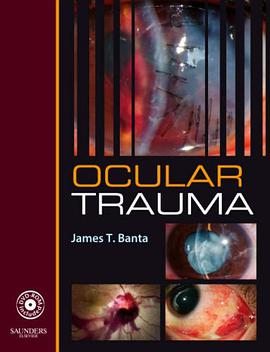 Ocular Trauma with DVD pdf epub mobi 电子书 下载