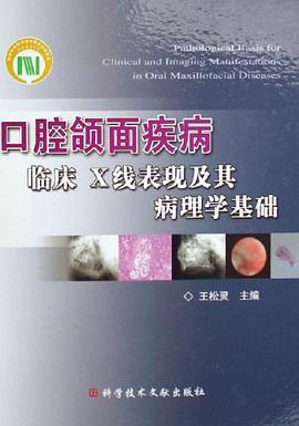 口腔颌面疾病临床X线表现及其病理学基础 pdf epub mobi 电子书 下载