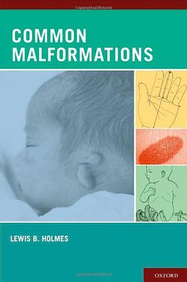 Common Malformations pdf epub mobi 电子书 下载